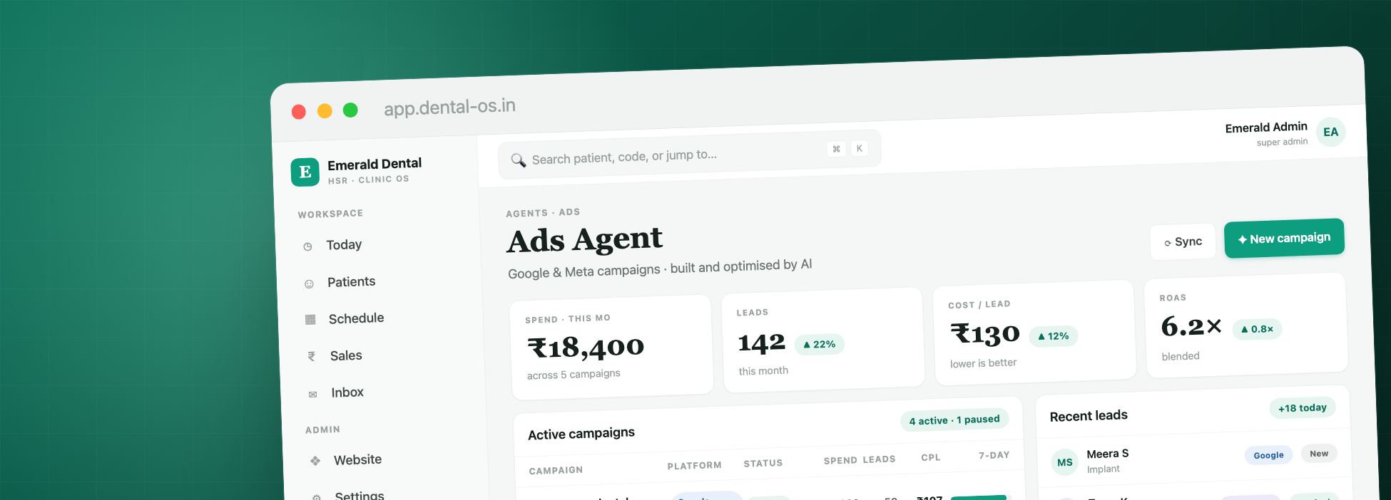 Dental OS — Ads screen